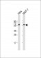 Pyruvate Kinase (PKM2) Antibody (C-term)