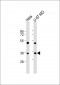Aurora-B (ARK/STK12) Antibody (N-term)