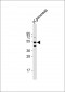 GIPR Antibody (Center)