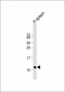 PPBP Antibody (N-term)