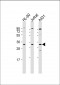 Caspase-3 (CASP3) Antibody (Center)