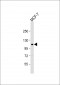 EphA2 Antibody (N-term)