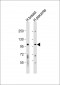 FGFR2 Antibody (N-term R22)