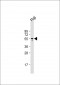 LYN Antibody (N-term)