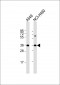 CTGF Antibody (C-term)