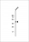 PIM1 Antibody (C-term)