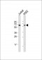 PIP5K1B Antibody (N-term)