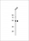 GSK3 alpha (GSK3A) Antibody (C-term)