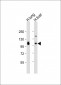 AOC3 Antibody (Center)