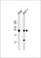 PSMB1 Antibody (C-term)