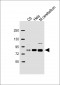 (Mouse) Rps6ka1 Antibody (C-term)