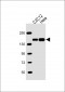 SMARCC1 Antibody (C-term)
