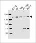 ROCK2 Antibody (C-term)