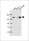 MAML2 Antibody (Center)