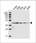 DFFA Antibody (C-term)