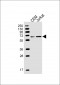 MEN1 Antibody (N-term)