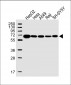 IGF2BP2 Antibody (C-term)