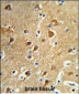 PPM1H Antibody (Center)