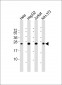 RAB5B Antibody