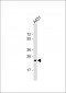 RAB5B Antibody