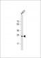 RAB5B Antibody