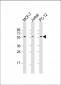 AKT2 Antibody