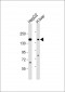 ABCC3 Antibody (Center)