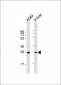 NNMT Antibody (Center)