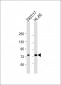 ABCD1 Antibody (Center)