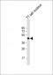 NKX2-1 Antibody (N-term)