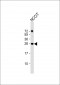 LIN28A Antibody (Center)