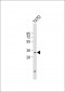 PSMB11 Antibody (C-term)