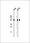 ATP6V1B1 Antibody (Center)