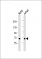 F11 Antibody (Center)