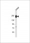 PTPRC Antibody (N-term)