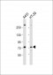 PAK6 Antibody (Center)