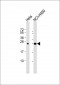 IL6 Antibody (Center)