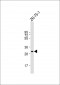 MYOGENIN Antibody (N-term)