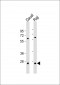 PSMB10 Antibody (C-term)