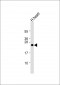 CLDN2 Antibody (C-term Y224)