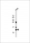 Thioredoxin (TRX) Antibody (N-term)