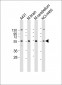 DRAGON (RGMB) Antibody (C-term)