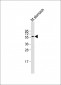 CRTR1 Antibody (N-term)