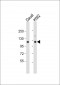 STAT2 Antibody (C-term)