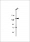 PODXL Antibody (C-term)