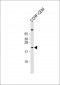 FXN Antibody (N-term)