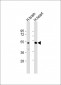 PCOLCE2 Antibody (Center)