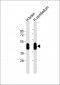 GFAP Antibody (N-term)