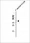 Myostatin (GDF8) Antibody (N-term)
