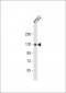 UBE4A Antibody (C-term)